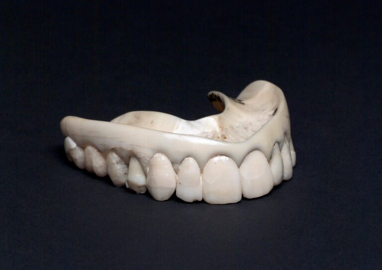 Waterloo Teeth | A History of Georgian Dentures